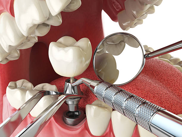 Best Emergency Cosmetic Dentistry in Wright City, MO